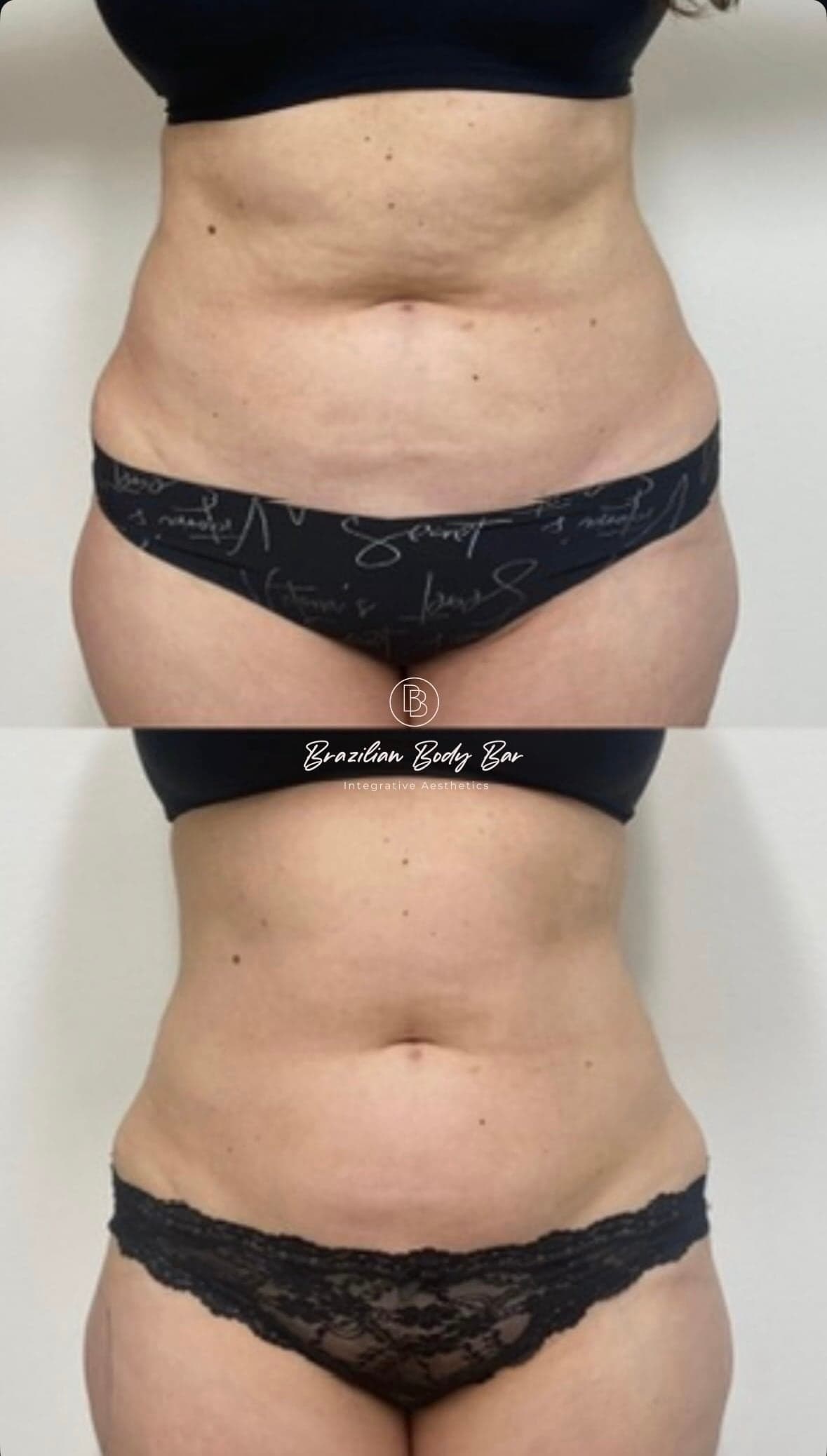 Brazilian Body Bar client before and after result 2
