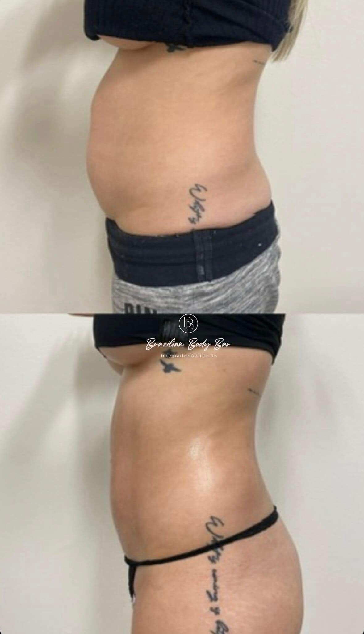 Brazilian Body Bar client before and after result 6