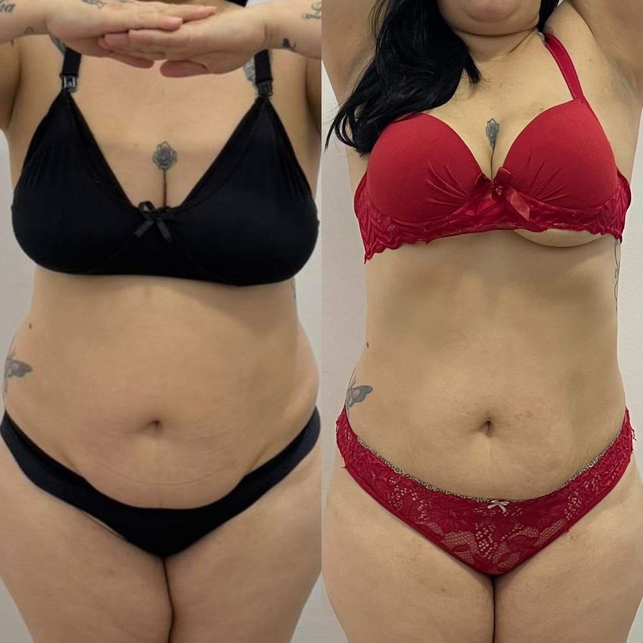 Brazilian Body Bar client before and after result 3