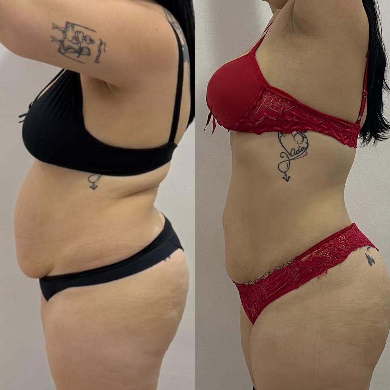Brazilian Body Bar client before and after result 4