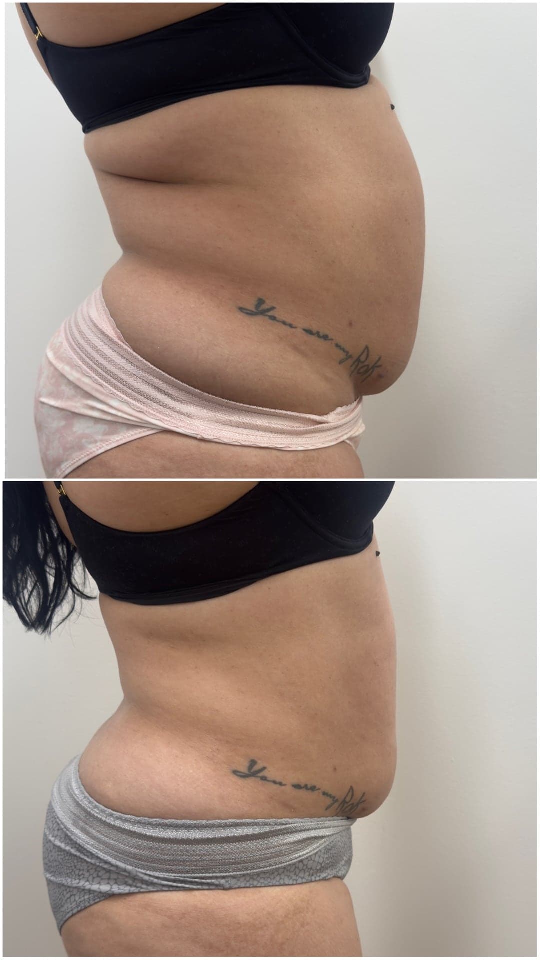 Brazilian Body Bar client before and after result 7