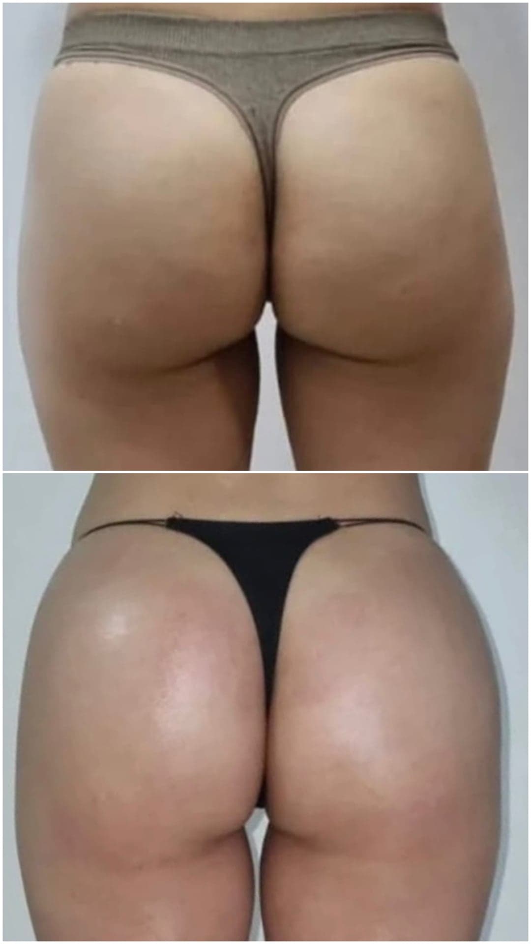Brazilian Body Bar client before and after result 3