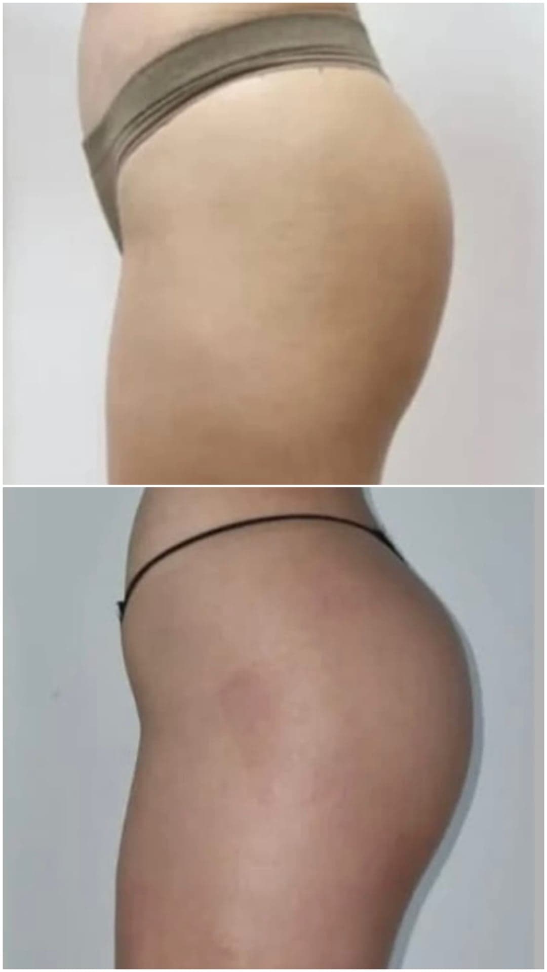 Brazilian Body Bar client before and after result 4