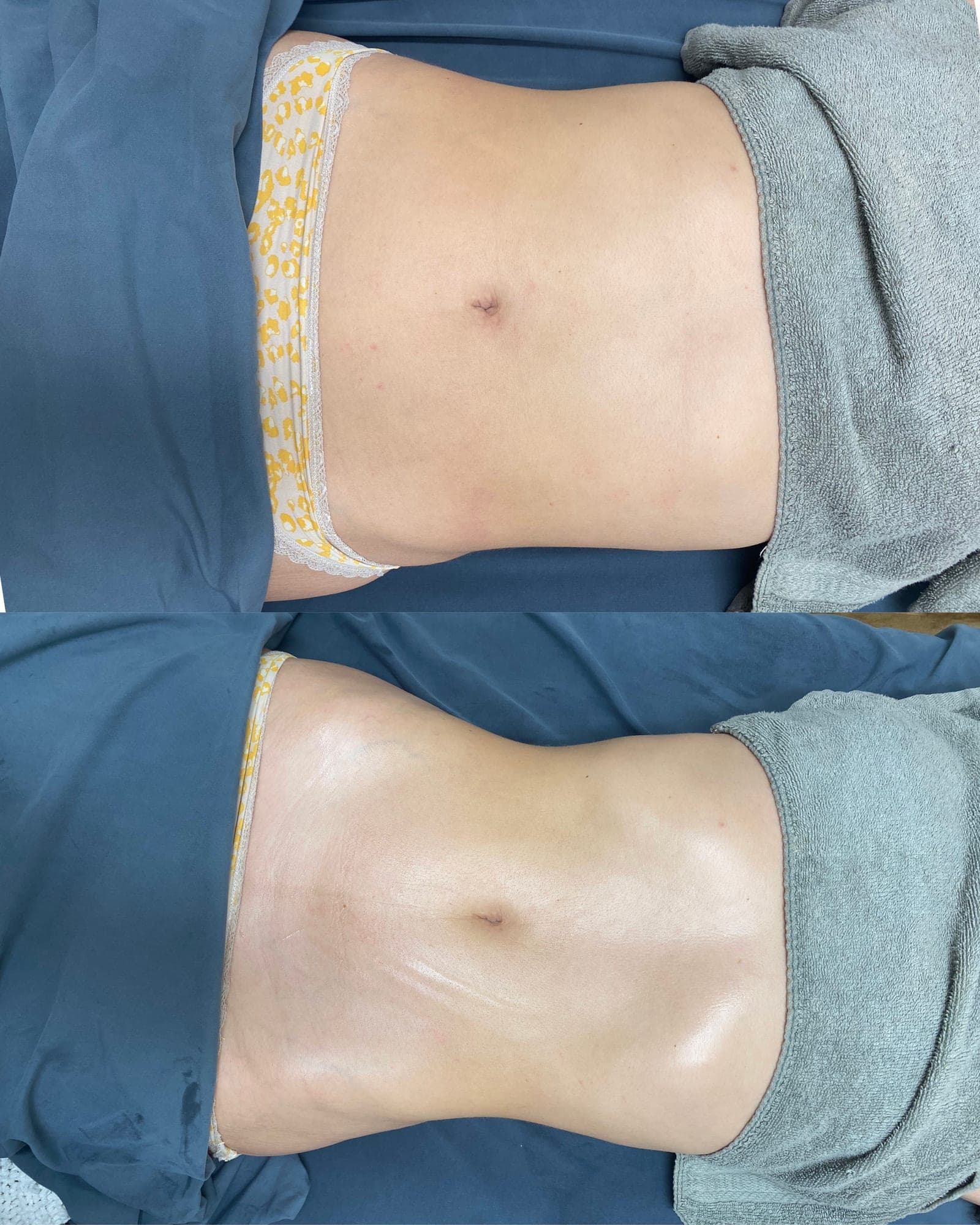 Brazilian Body Bar client before and after result 2