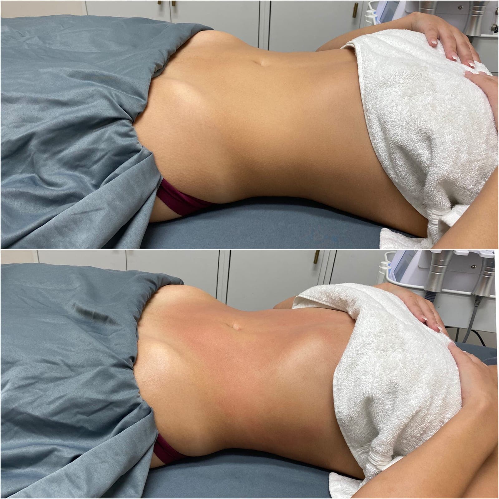Brazilian Body Bar client before and after result 5