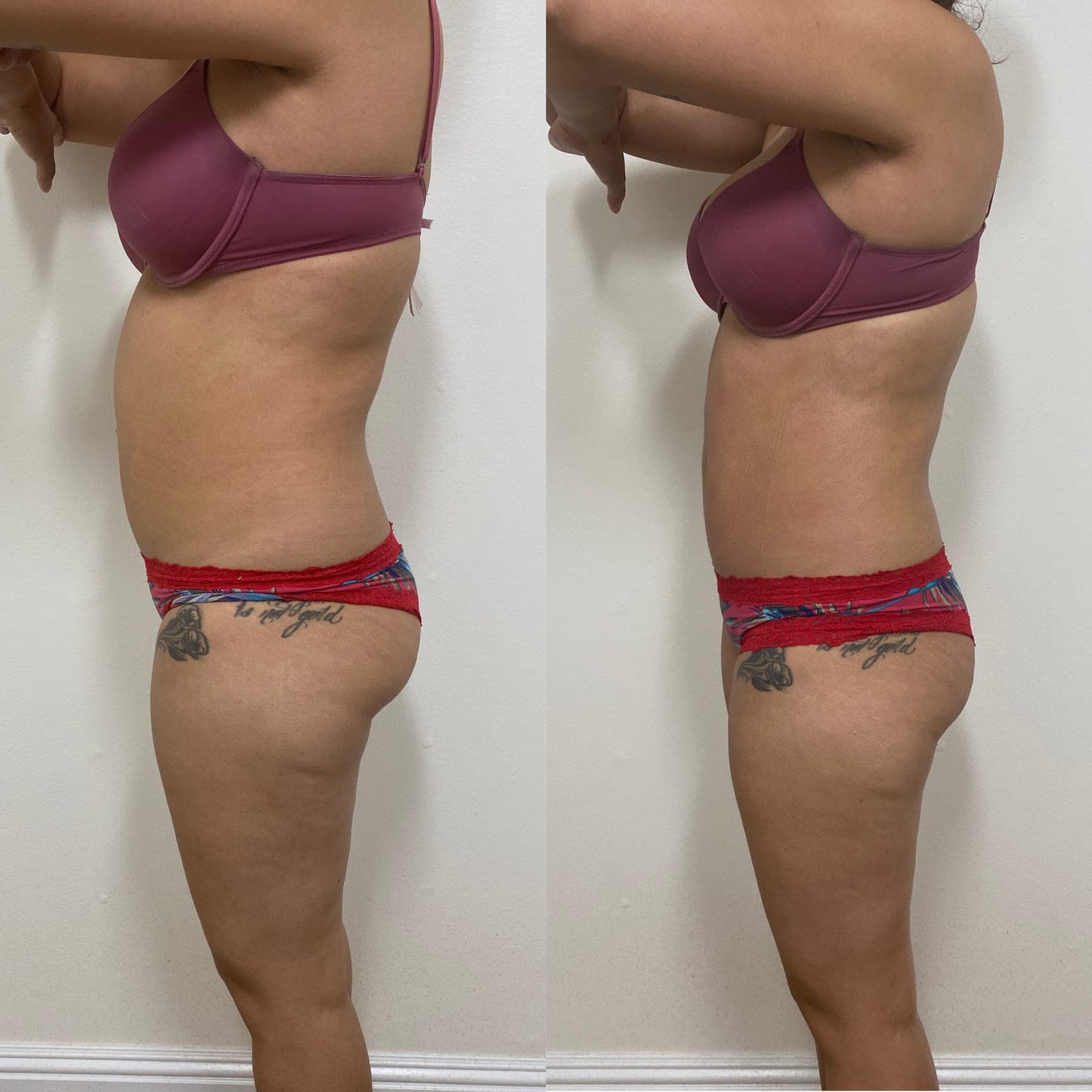 Brazilian Body Bar client before and after result 6