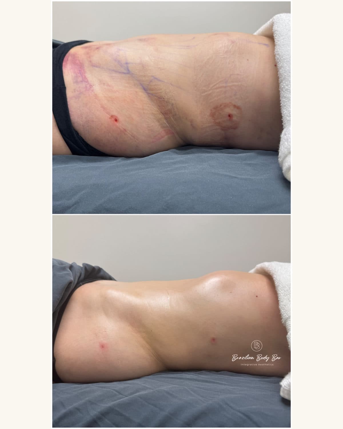 Brazilian Body Bar client before and after result 5