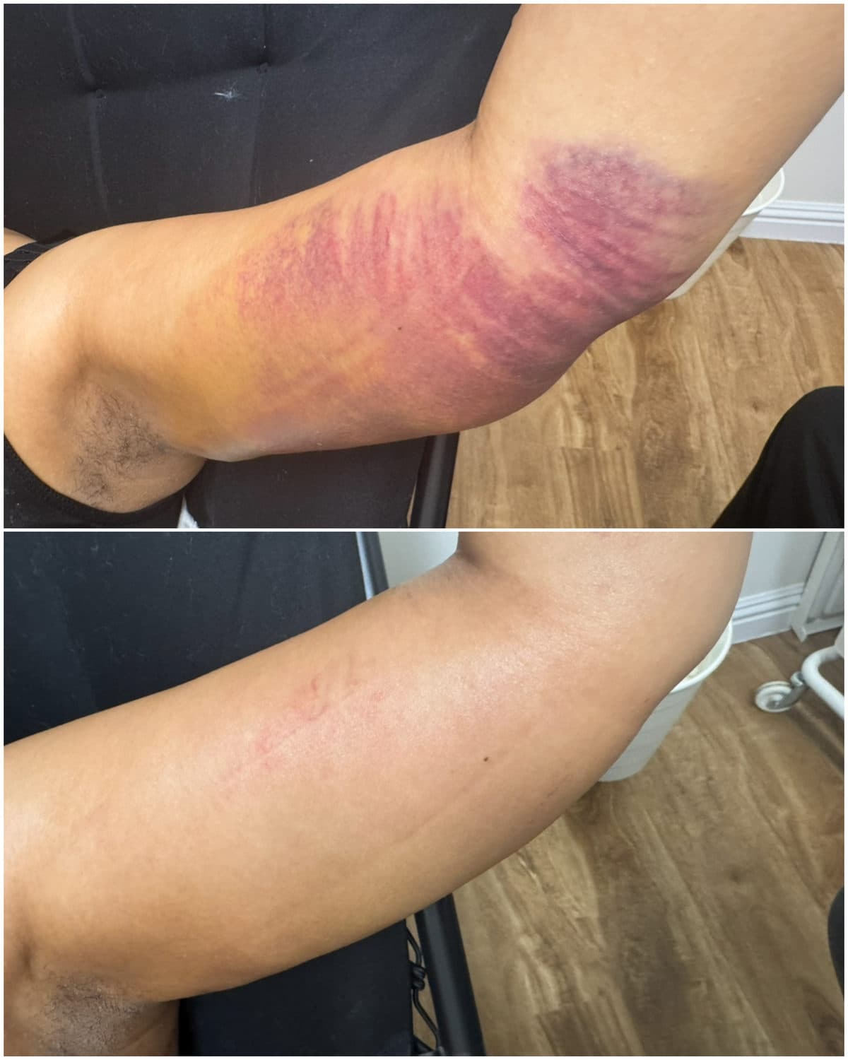 Brazilian Body Bar client before and after result 6