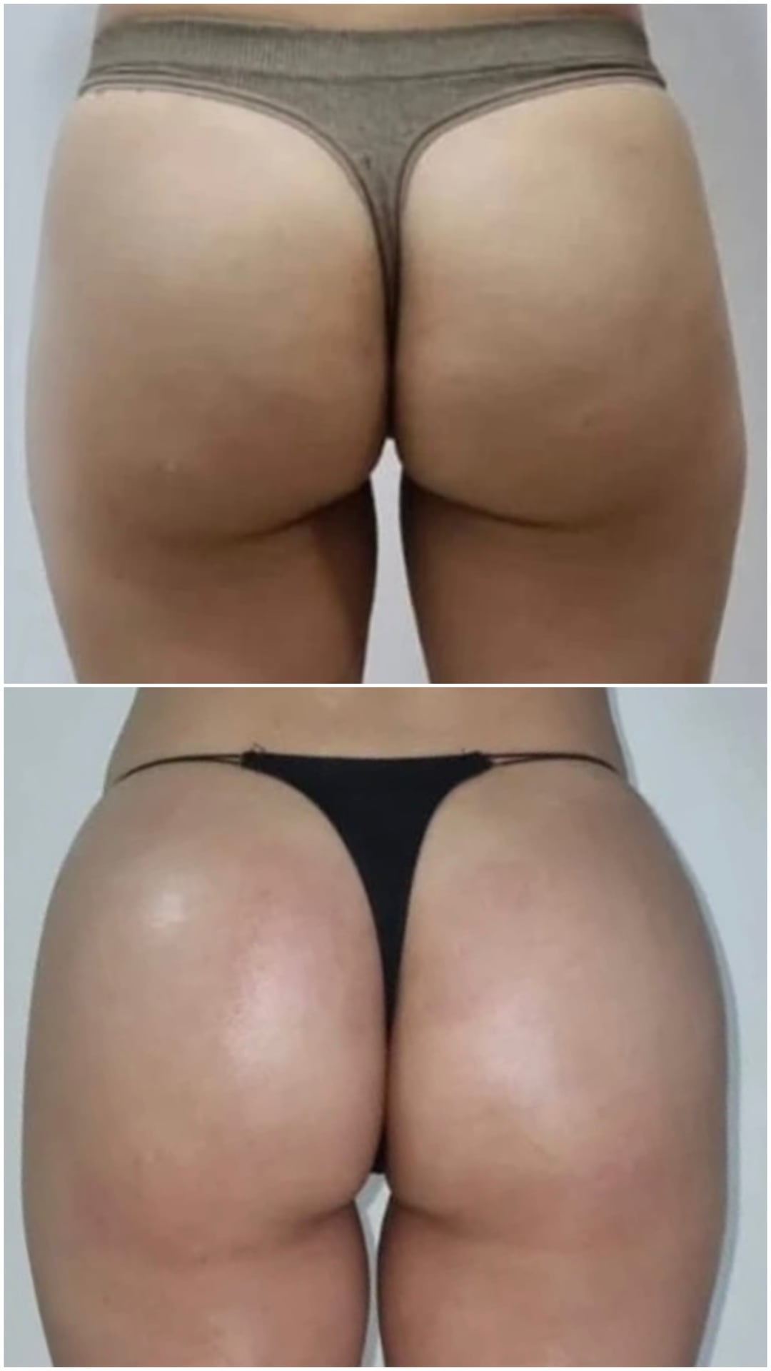 Brazilian Body Bar client before and after result 3