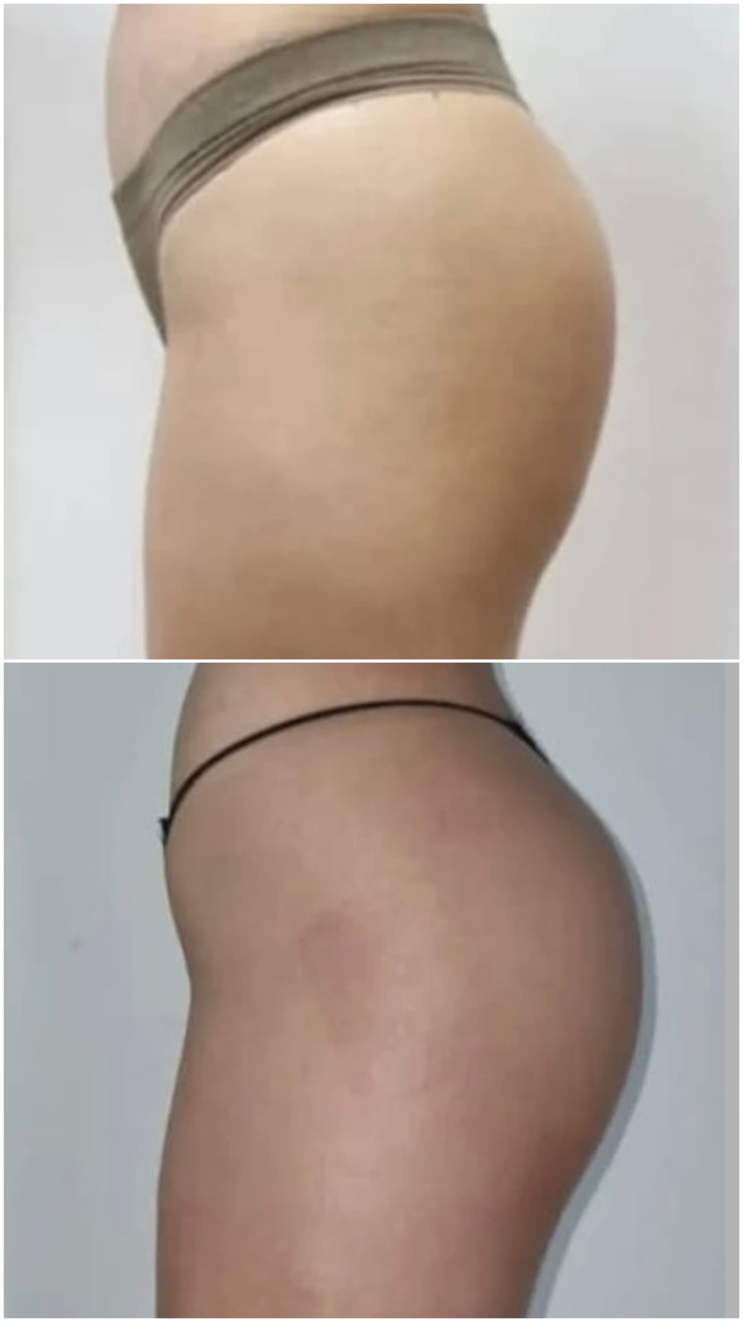 Brazilian Body Bar client before and after result 4